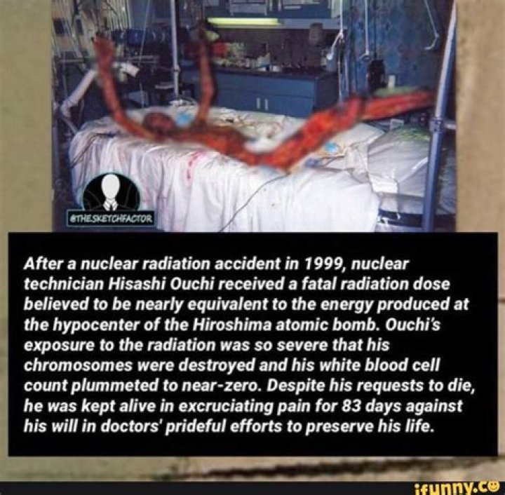 The aftermath of radiation exposure