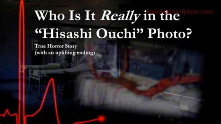 Unveiling The Truth: Hisashi Ouchi Real Photos Bed