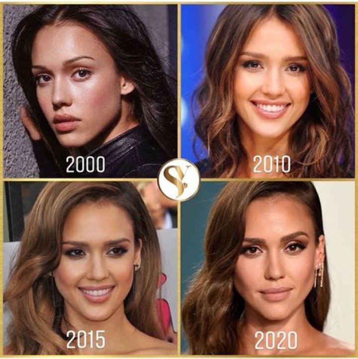 Unveiling The Truth Behind Jessica Alba's Lip Filler Journey