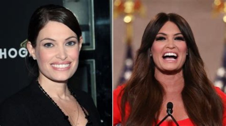The Transformation Journey Of Kimberly Guilfoyle: Unveiling Cosmetic Surgery Secrets
