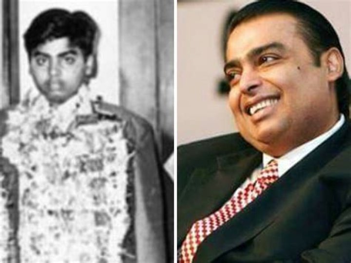 Mukesh Ambani's Health Journey: A Deep Dive Into His Surgery