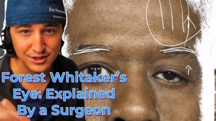 Unveiling The Mystery: What Happened To Forest Whitaker's Eye?
