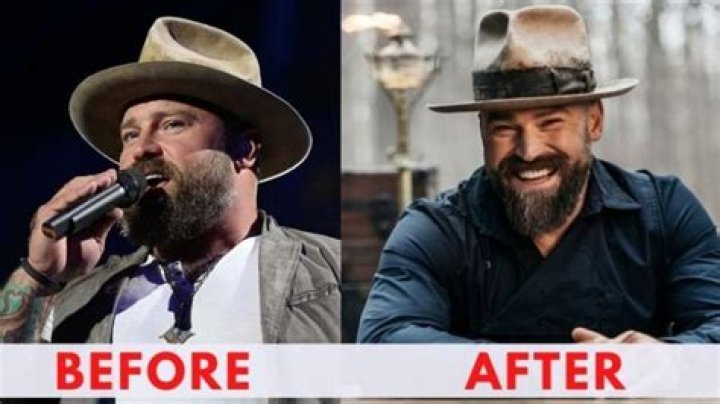 Zac Brown's Incredible Weight Loss Journey: From Country Star To Fitness Inspiration